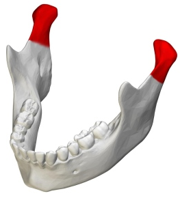 Gnatologia bite: per disturbi dell'apparato masticatorio